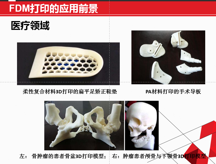 FDM 技術(shù)3D打印機(jī)應(yīng)用領(lǐng)域廣泛，在可預(yù)見的未來無可估量！